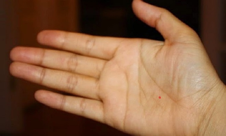 Ý nghĩa nốt ruồi son trong lòng bàn tay phải ở nam giới